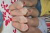 Thumnail / 2 / 10 / 49